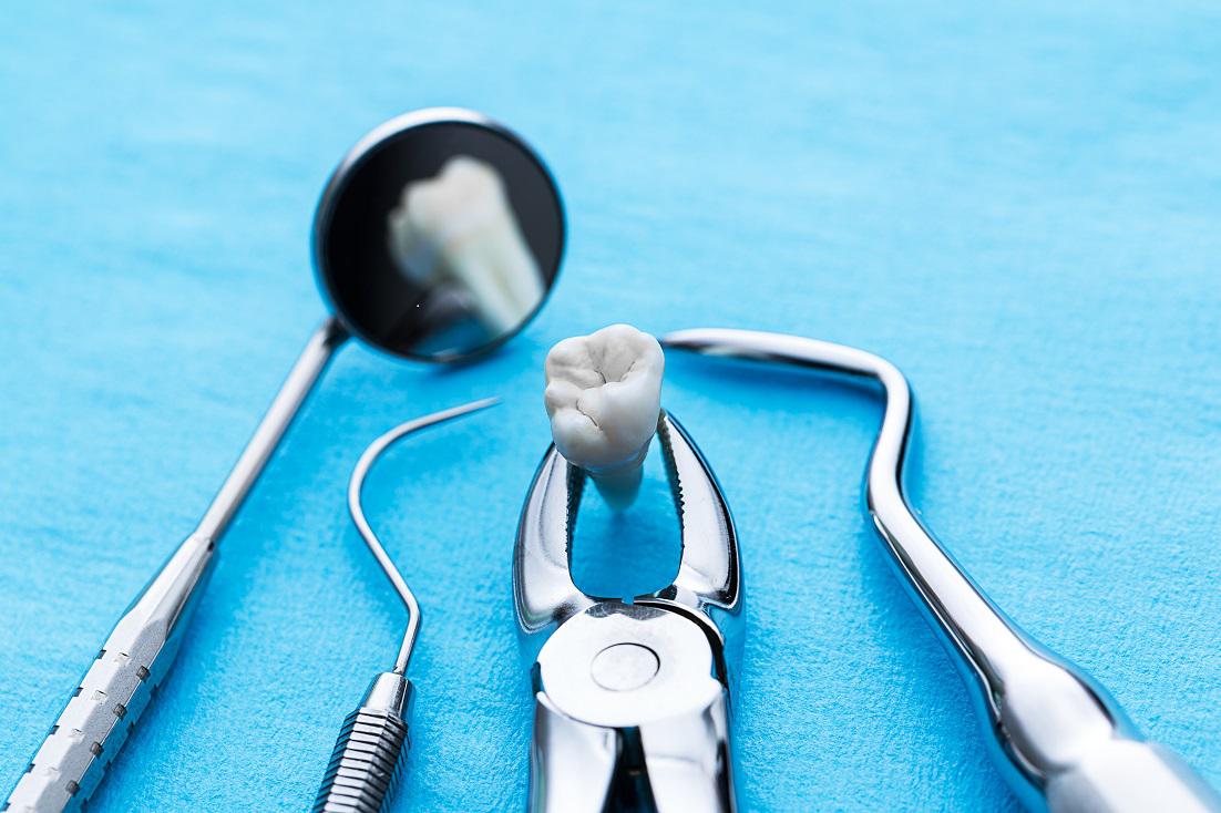 Can You Benefit From a Tooth Extraction?